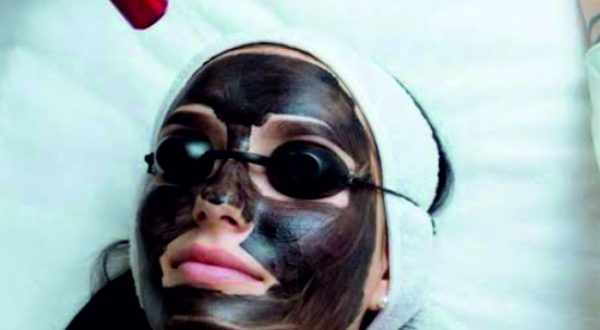 2-Carbon Laser Facial