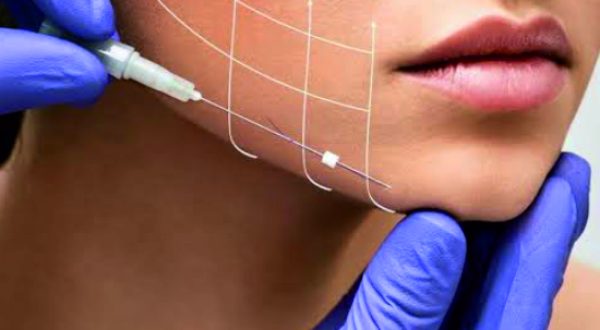 26-Thread, Face lift