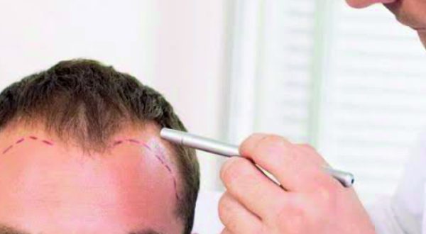 30-QR 678 Hair Regrowth Treatment