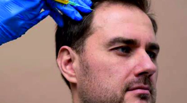 7-Hair PRP Treatment